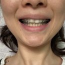 참좋은김치과의원 네이버블로그
