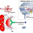 만성 통증 이미지