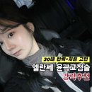 서울청담닥터아나파의원 | 청담]30대 중반 윤곽라인+리프팅을 한번에! 엠레드 엘란쎄 윤곽고정술 한달 경과 후기