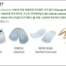 알즈너대한 이미지