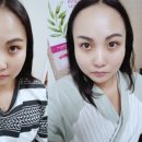 부천상동피부관리 :: 3D동안관리 금충초 스킨앤바디
