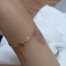 신피부과의원 | 흉터야 제발 남지말아라ㅠㅠ 화상치료 후기 / 대구동성로 신피부과의원, 듀오덤엑스트라씬, 화상습윤밴드