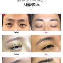 동방의원 네이버블로그