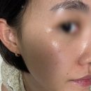 심톨이 개발한 키에라 세라스테롤 그린 리프 모델링팩 마스크 내돈내산 후기