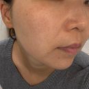 뚝담집 | 하남피부관리 아늘담에스테틱 모공스파로 맑아진 피부 꼼꼼한 관리 후기