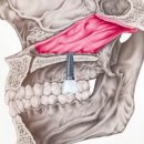 365더편한치과의원 | 군포 산본이편한세상아파트 근처치과, 임플란트 실패증상? <전문의 작성>