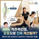 벨르독 | 탄현PT 척추측만증, 진짜 운동으로 개선될까요?