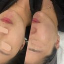 판암역네거리 | ㅣ 뷰마르 ㅣ 대전 대전 피부관리 추천! 1회만으로 물광 톤업되는 스킨플래닝 솔직후기