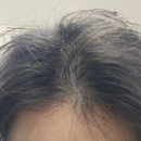 99금방 | 99vital 꽝없는 설날 이벤트 (아웃백 상품권)! 갓성비 비오틴 주문 후기