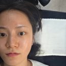 설브 - 유성구 계룡로123번길 30 | [대전 용문동] 대전 피부관리 잘하는 곳 MTS 관리 리얼후기_설브 용문점