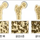 칼슘제 고르는 법 및 제품 비교 ＜소비자의 눈＞ 이미지