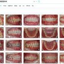 강서바른이치과교정과치과의원 네이버블로그