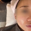 리드유스킨 | 의정부 민락동 여드름압출 잘하는곳 , 리드유스킨 🩵