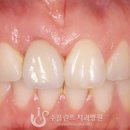 수플란트치과병원 이미지