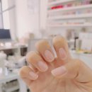 요온네일 이미지