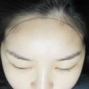 보떼헤어라인