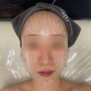 [상무지구 피부관리] LDM 물방울 리프팅 &amp; 라인젯 후기 &lt;미엘멜로우&gt;