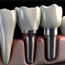 일산웰치과의원 이미지