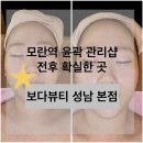 성남모란한의원 | 모란 피부관리 윤곽관리 다이어트 맛집 [보다뷰티]