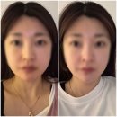 (주)원메디코 | 인천피부관리 첫방문이벤트♬에이블메디스킨 인천부평점(내돈내산)♪