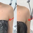 중부대로 | [수원] 더스무스왁싱와이존테라피수원인계점 : 인계동부유방관리 후기