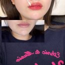 구미입술문신, 문성 루미아스칼프 립타투 한 달 후기