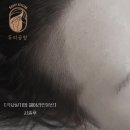 두피공방헤어라인
