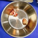 서울치과재료상사 | 40대 사랑니 발치 후기｜시험관 중 서울이턱치과 매복사랑니 발치