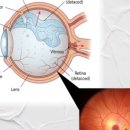 1001안경원 앞 이미지