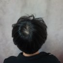 일러스라인 | 탈모치료엔 두피smp 신림 _ 일러스라인 smp 후기 !!!