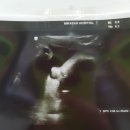 임신34주 / 미래안산부인과 정기검진, 임산부 일상 증상. 속쓰림. 소화불량. 불면증. 가진통