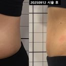 아크로한의원 이미지