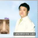 써지코 네이버블로그