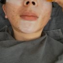 그린필스킨케어 이미지