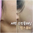 림스플래닝