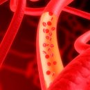 앰비션PT센터 이미지