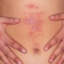 자강한의원 이미지