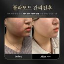 원모드