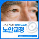 판교잘보는연세안과의원 | 판교안과후기 노안 교정과 수술 전 정밀검사의 중요성