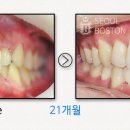 보스톤미소치과 이미지