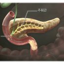 췌장암에 대하여 전반적인 개요 이미지