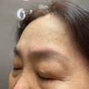 서면다정약국 | 부산서면보톡스 잘하는곳 이마 미간 보톡스 내돈내산 후기(가격,부작용,주기)