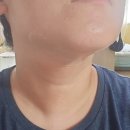 닥터스에스테틱 | 닥터스영앤영앤모드 턱선 홈케어 안면윤곽 관리 고민될 때 사용해본 후기