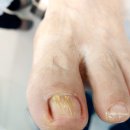 레푸스목포
