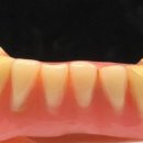 참진치과기공소 이미지