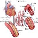 서울아산병원 심장병원 2014년 10월 건강정보 이미지