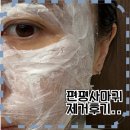 메이퓨어 동백점 | 얼굴 편평사마귀 제거 후기 / 듀오덤 언제까지? / 한관종, 비립종, 쥐젖 제거 / 얼굴 전체 91개 제거...