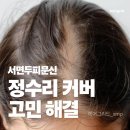 헤어량 | 서면두피문신 정수리가 하얗게... 해결 방법은? 나도 정수리탈모