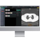 장소프트 이미지