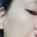 바이셀 - 김포시 해평로 149 | 엑소제닉스 바이오포텐트셀 줄기세포앰플 사용후기 주름탄력 집중케어템